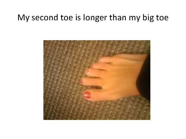 My second toe is longer than my big toe My second toe is longer than my big toe