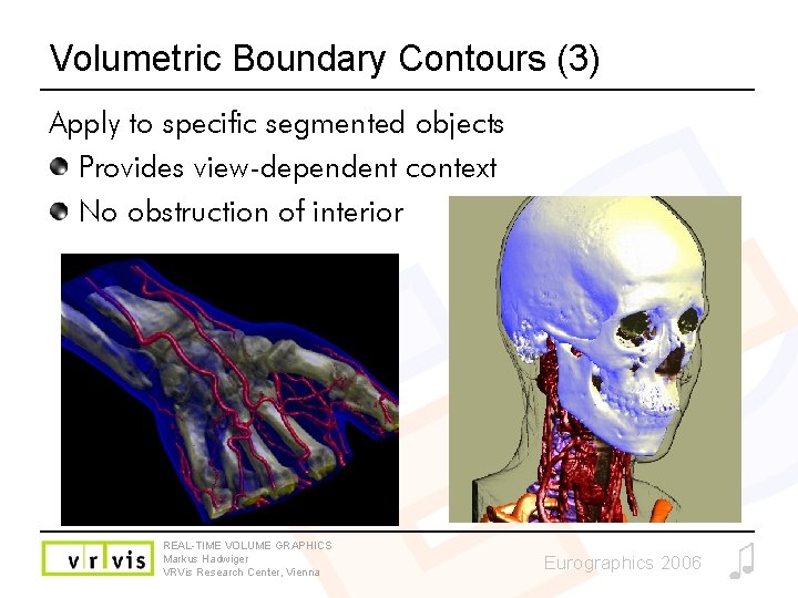 Volumetric Boundary Contours (3) Apply to specific segmented objects Provides view-dependent context No obstruction