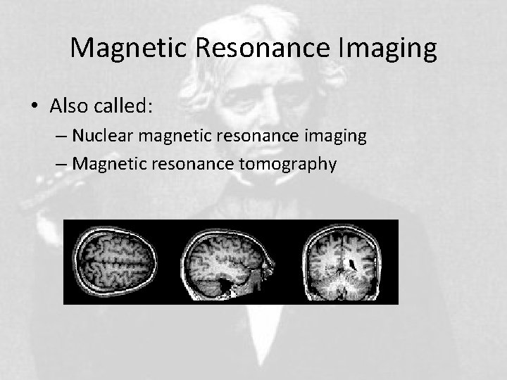 Magnetic Resonance Imaging • Also called: – Nuclear magnetic resonance imaging – Magnetic resonance