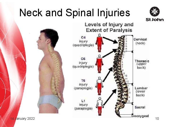 Neck and Spinal Injuries 14 January 2022 10 