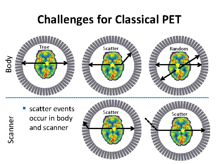 Challenges for Classical PET Scatter Random Scatter Scanner Body True § scatter events occur