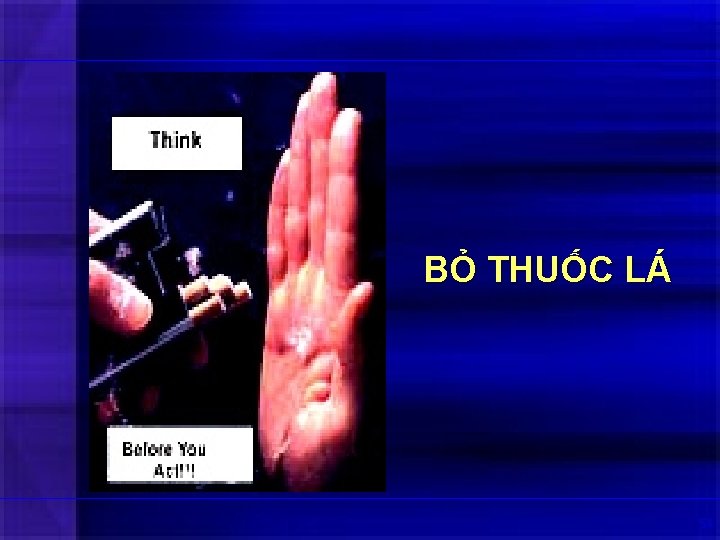 BỎ THUỐC LÁ 54 