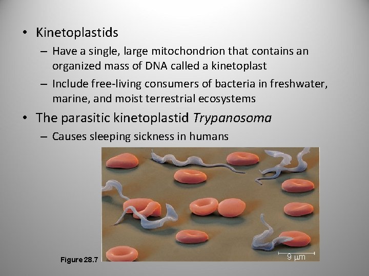  • Kinetoplastids – Have a single, large mitochondrion that contains an organized mass