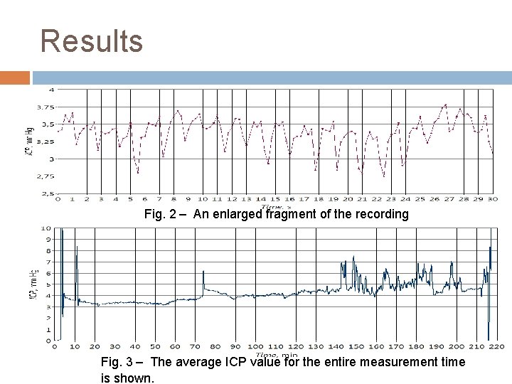 Results Fig. 2 – An enlarged fragment of the recording (b). Fig. 3 –