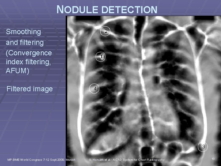 NODULE DETECTION Smoothing and filtering (Convergence index filtering, AFUM) Filtered image MP-BME World Congress