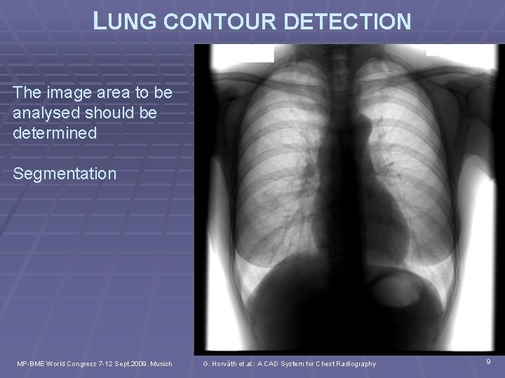 LUNG CONTOUR DETECTION The image area to be analysed should be determined Segmentation MP-BME