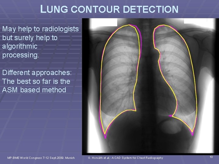 LUNG CONTOUR DETECTION May help to radiologists but surely help to algorithmic processing. Different