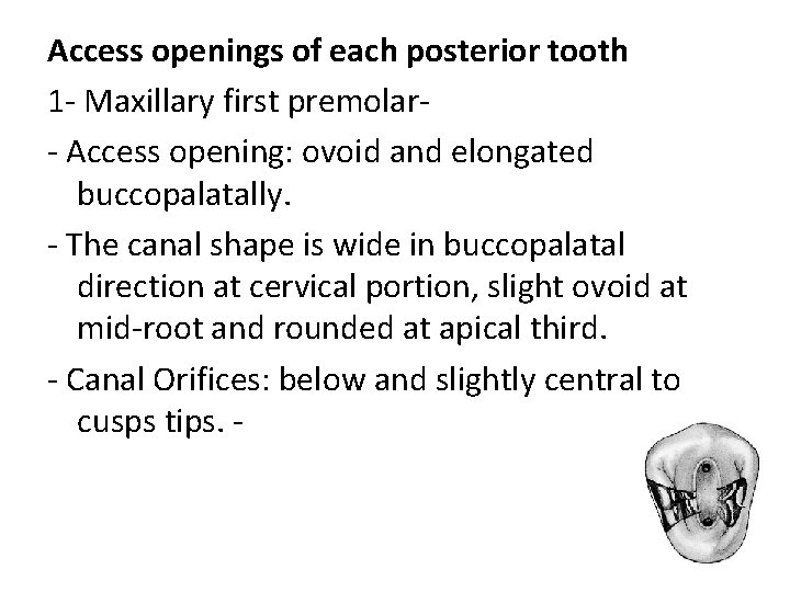 Access openings of each posterior tooth 1 - Maxillary first premolar- Access opening: ovoid