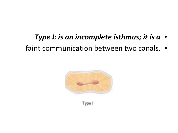 Type I: is an incomplete isthmus; it is a • faint communication between two
