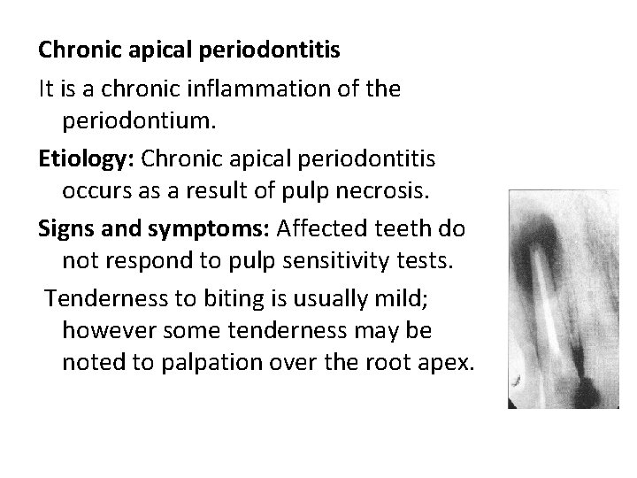 Chronic apical periodontitis It is a chronic inflammation of the periodontium. Etiology: Chronic apical