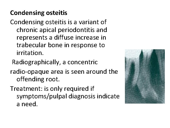 Condensing osteitis is a variant of chronic apical periodontitis and represents a diffuse increase