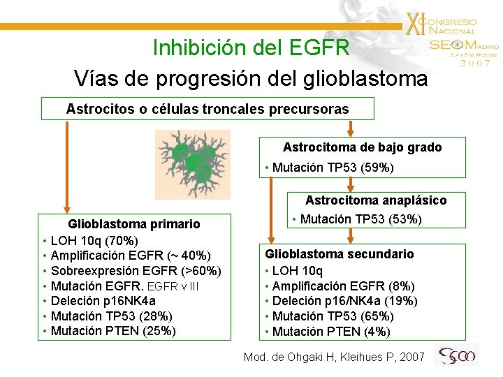 Inhibición del EGFR Vías de progresión del glioblastoma Astrocitos o células troncales precursoras Astrocitoma