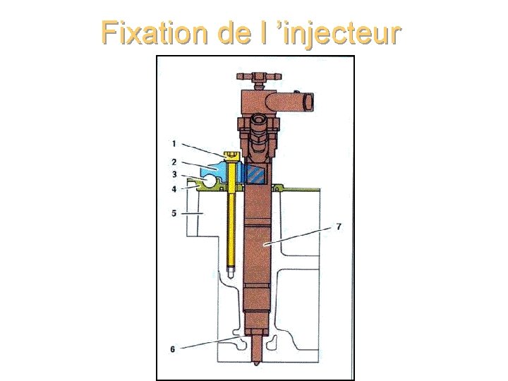 Fixation de l ’injecteur 