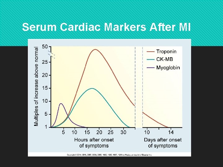 Serum Cardiac Markers After MI Copyright © 2014 by Mosby, an imprint of Elsevier