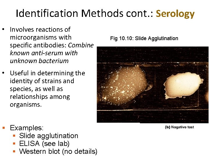 Identification Methods cont. : Serology • Involves reactions of microorganisms with specific antibodies: Combine Identification Methods cont. : Serology • Involves reactions of microorganisms with specific antibodies: Combine