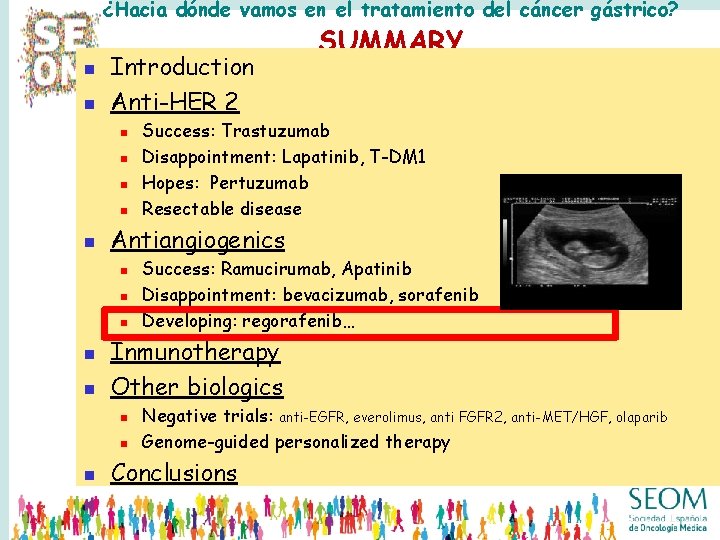 ¿Hacia dónde vamos en el tratamiento del cáncer gástrico? n n Introduction Anti-HER 2 ¿Hacia dónde vamos en el tratamiento del cáncer gástrico? n n Introduction Anti-HER 2