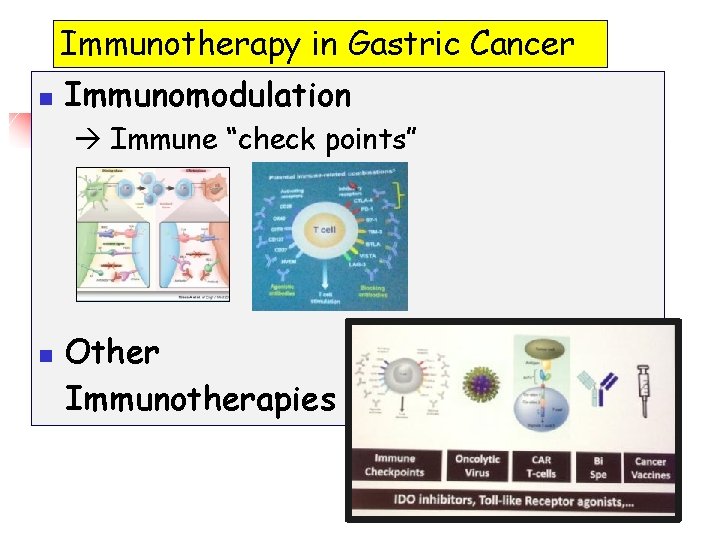 Immunotherapy in Gastric Cancer n Immunomodulation Immune “check points” n Other Immunotherapies Immunotherapy in Gastric Cancer n Immunomodulation Immune “check points” n Other Immunotherapies