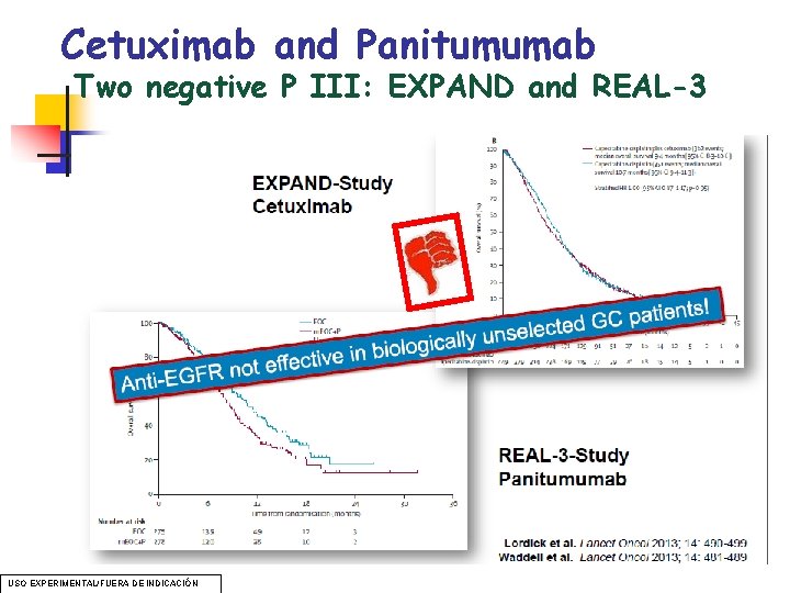 Cetuximab and Panitumumab Two negative P III: EXPAND and REAL-3 USO EXPERIMENTAL/FUERA DE INDICACIÓN Cetuximab and Panitumumab Two negative P III: EXPAND and REAL-3 USO EXPERIMENTAL/FUERA DE INDICACIÓN