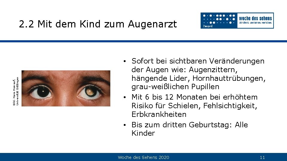 Bild: Hans Hoerauf, Universität Göttingen 2. 2 Mit dem Kind zum Augenarzt • Sofort