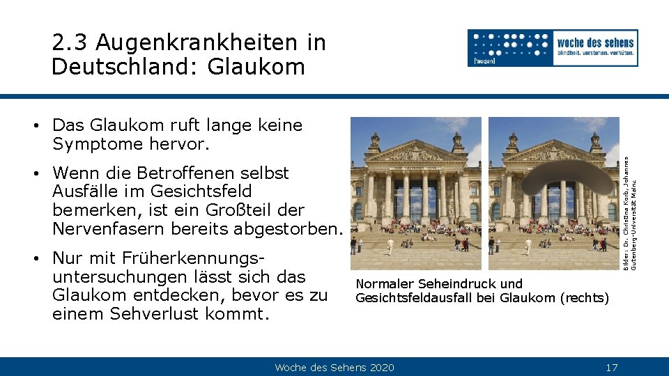 2. 3 Augenkrankheiten in Deutschland: Glaukom Bilder: Dr. Christina Korb, Johannes Gutenberg-Universität Mainz •