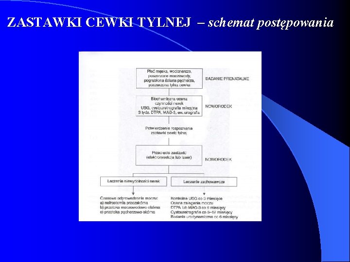 ZASTAWKI CEWKI TYLNEJ – schemat postępowania 