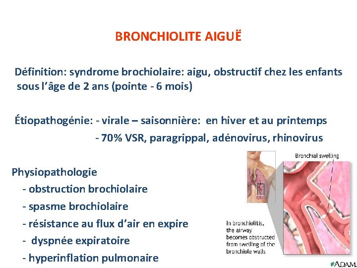 BRONCHIOLITE AIGUË Définition: syndrome brochiolaire: aigu, obstructif chez les enfants sous l’âge de 2