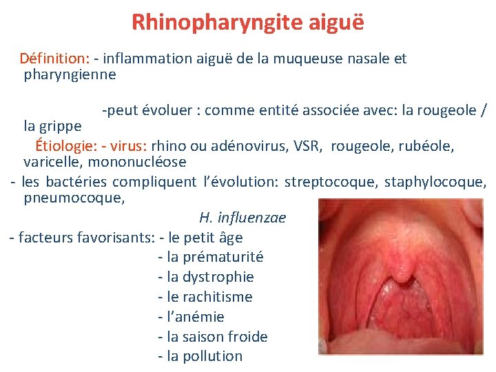 Rhinopharyngite aiguë Définition: - inflammation aiguë de la muqueuse nasale et pharyngienne -peut évoluer