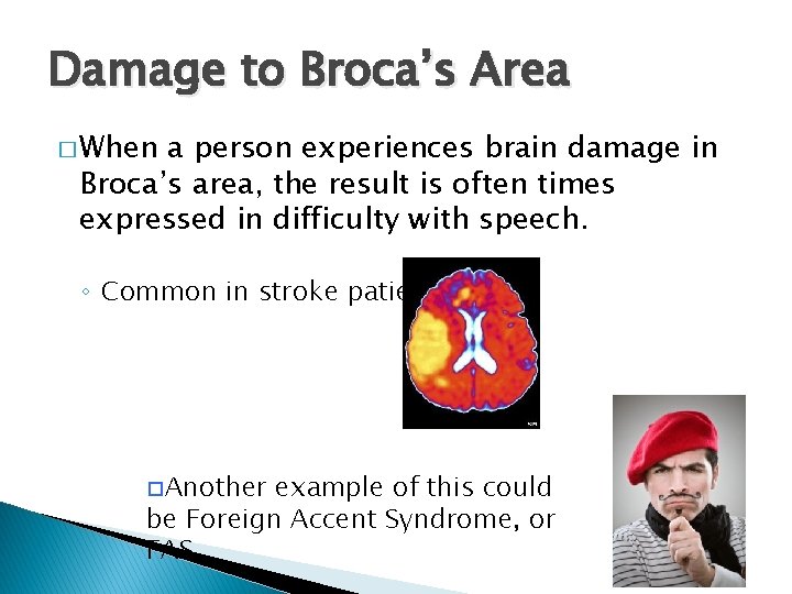 Damage to Broca’s Area � When a person experiences brain damage in Broca’s area,