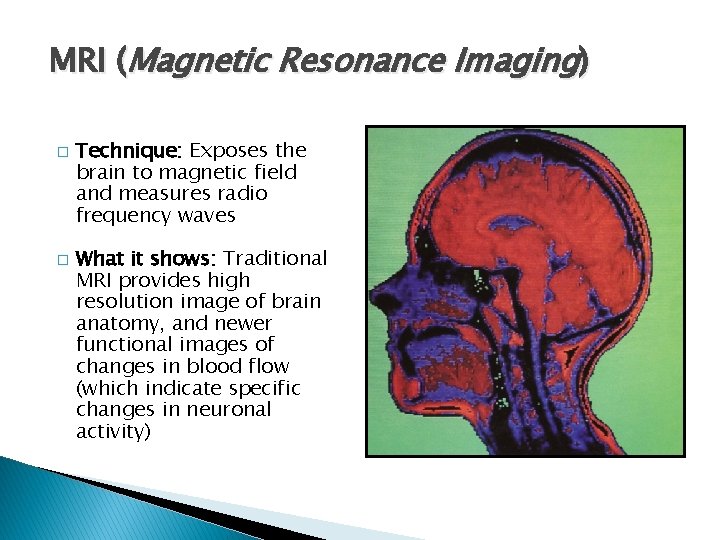 MRI (Magnetic Resonance Imaging) � � Technique: Exposes the brain to magnetic field and