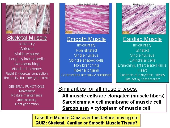 Skeletal Muscle Voluntary Striated Multinucleated Long, cylindrical cells Non-branching Attached to bones Rapid &