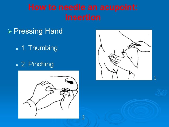 How to needle an acupoint: Insertion Ø Pressing Hand l 1. Thumbing l 2.