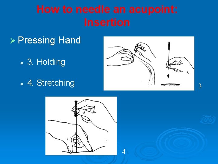 How to needle an acupoint: Insertion Ø Pressing Hand l 3. Holding l 4.