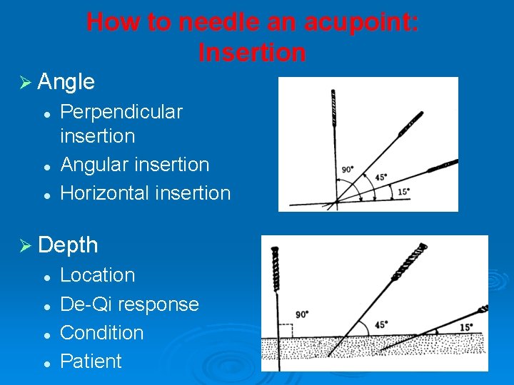 How to needle an acupoint: Insertion Ø Angle l l l Perpendicular insertion Angular