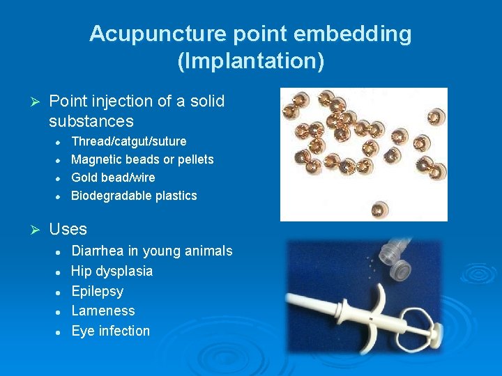 Acupuncture point embedding (Implantation) Ø Point injection of a solid substances l l Ø