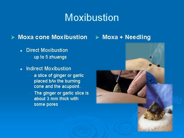 Moxibustion Ø Moxa cone Moxibustion l Direct Moxibustion • up to 5 zhuangs l