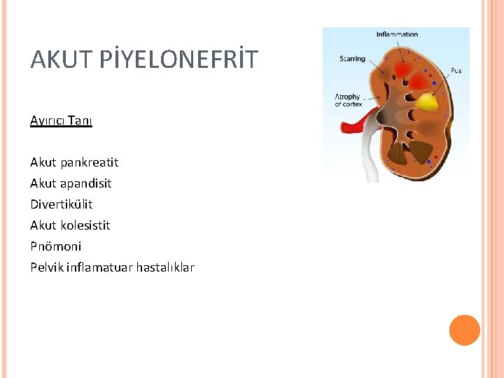 AKUT PİYELONEFRİT Ayırıcı Tanı Akut pankreatit Akut apandisit Divertikülit Akut kolesistit Pnömoni Pelvik inflamatuar