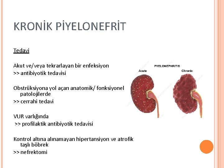 KRONİK PİYELONEFRİT Tedavi Akut ve/veya tekrarlayan bir enfeksiyon >> antibiyotik tedavisi Obstrüksiyona yol açan