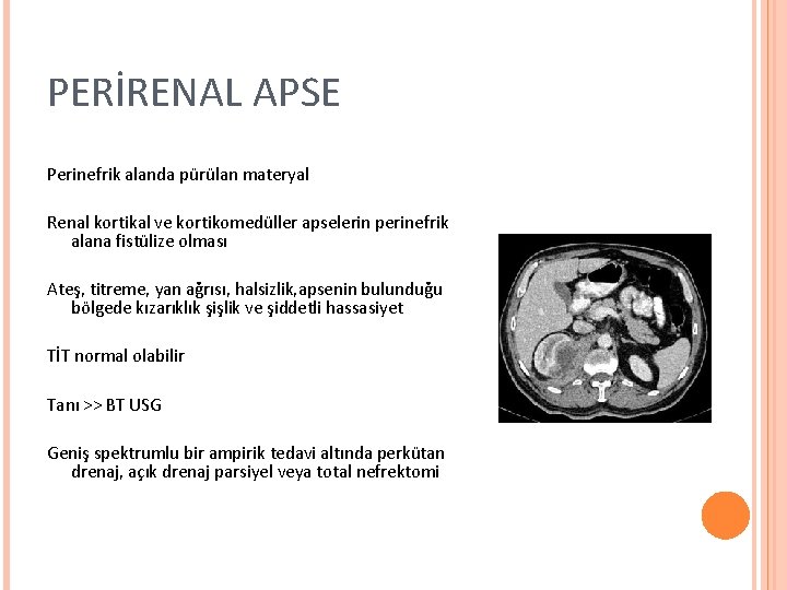 PERİRENAL APSE Perinefrik alanda pürülan materyal Renal kortikal ve kortikomedüller apselerin perinefrik alana fistülize