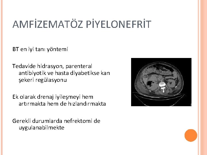 AMFİZEMATÖZ PİYELONEFRİT BT en iyi tanı yöntemi Tedavide hidrasyon, parenteral antibiyotik ve hasta diyabetikse