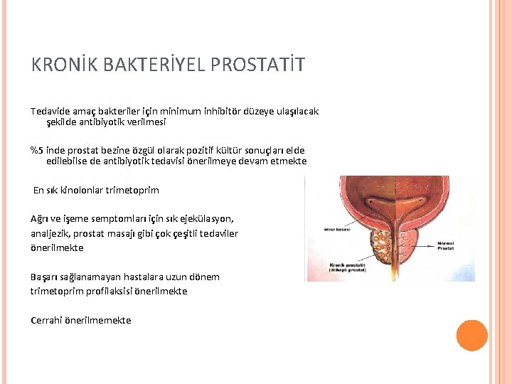 KRONİK BAKTERİYEL PROSTATİT Tedavide amaç bakteriler için minimum inhibitör düzeye ulaşılacak şekilde antibiyotik verilmesi