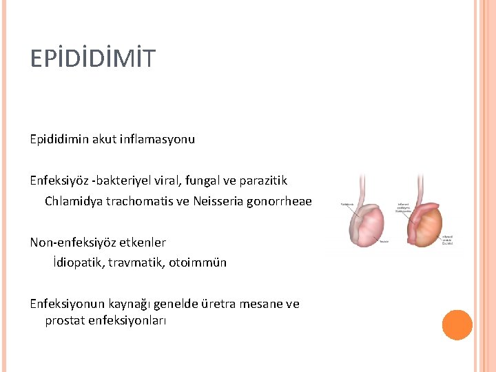 EPİDİDİMİT Epididimin akut inflamasyonu Enfeksiyöz -bakteriyel viral, fungal ve parazitik Chlamidya trachomatis ve Neisseria