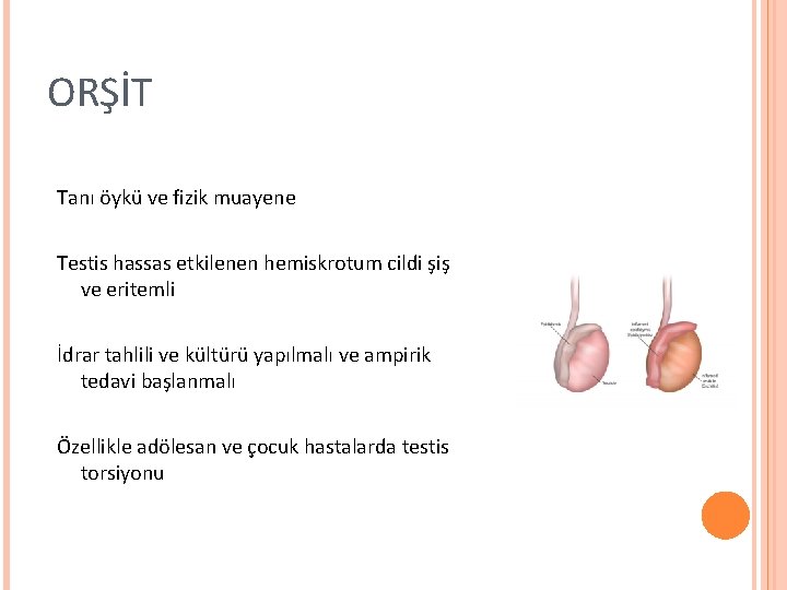 ORŞİT Tanı öykü ve fizik muayene Testis hassas etkilenen hemiskrotum cildi şiş ve eritemli