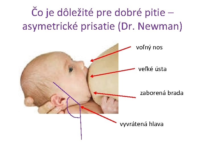 Čo je dôležité pre dobré pitie – asymetrické prisatie (Dr. Newman) voľný nos veľké