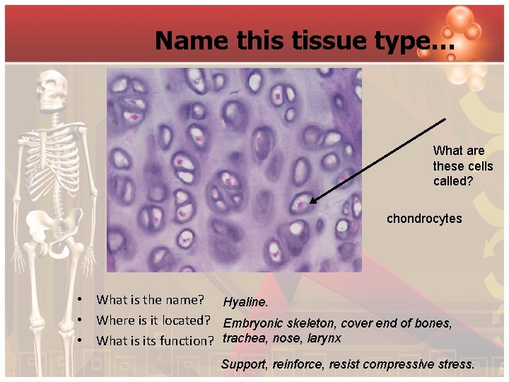 Name this tissue type… What are these cells called? chondrocytes • What is the