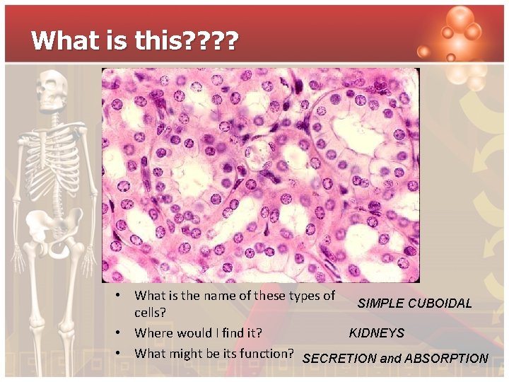 What is this? ? • What is the name of these types of SIMPLE