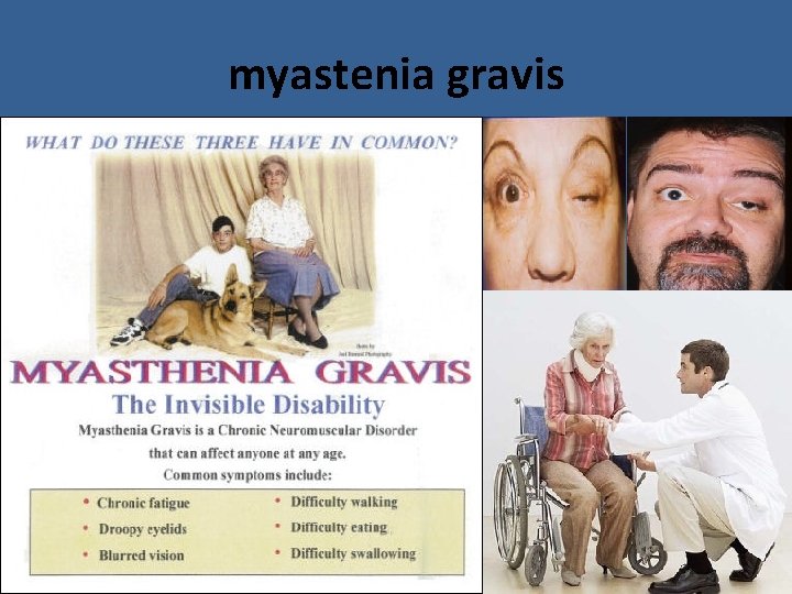 myastenia gravis myastenia gravis