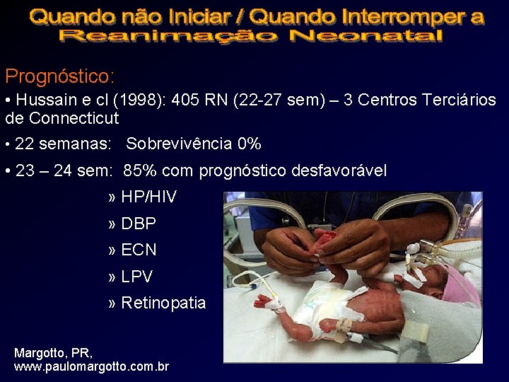 Prematuridade Extrema Ainda Um Desafiopredico Prognstica Paulo R