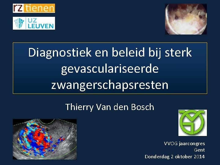 Diagnostiek en beleid bij sterk gevasculariseerde zwangerschapsresten Thierry Van den Bosch VVOG jaarcongres Gent