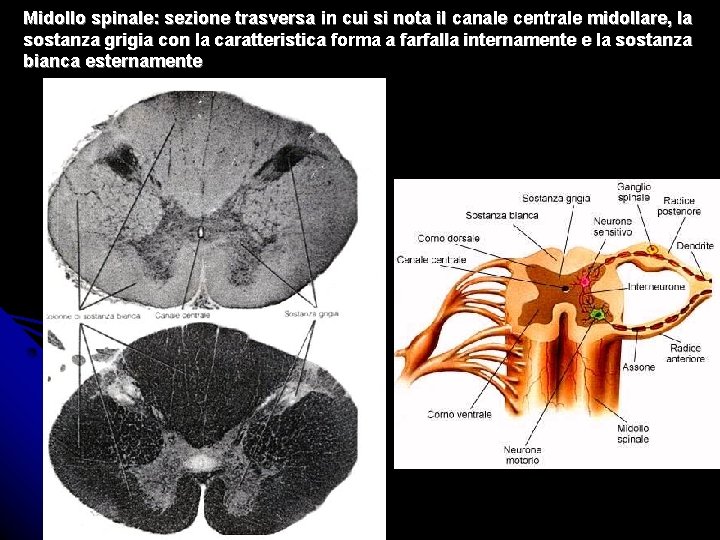 Midollo spinale: sezione trasversa in cui si nota il canale centrale midollare, la sostanza