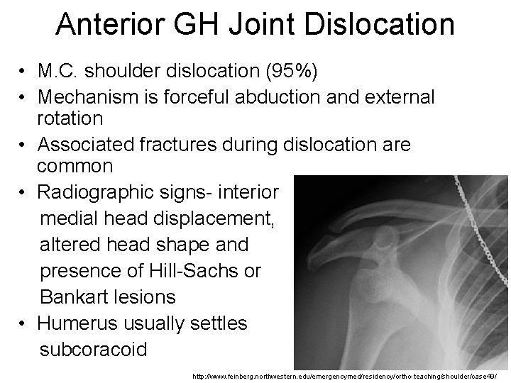 Anterior GH Joint Dislocation • M. C. shoulder dislocation (95%) • Mechanism is forceful